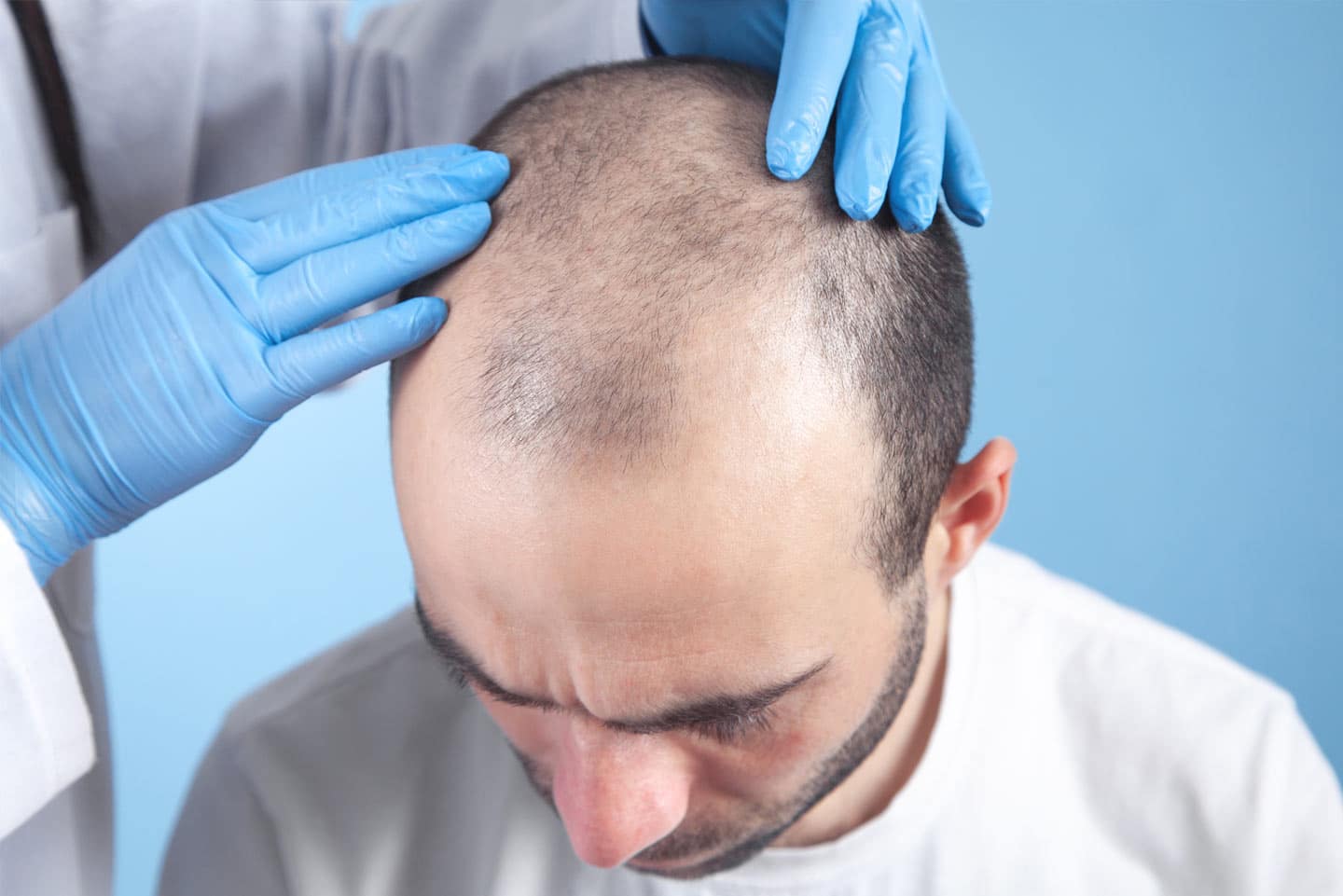 Hair-Restoration-treatments Hair-Restoration wellesley premier dermatology