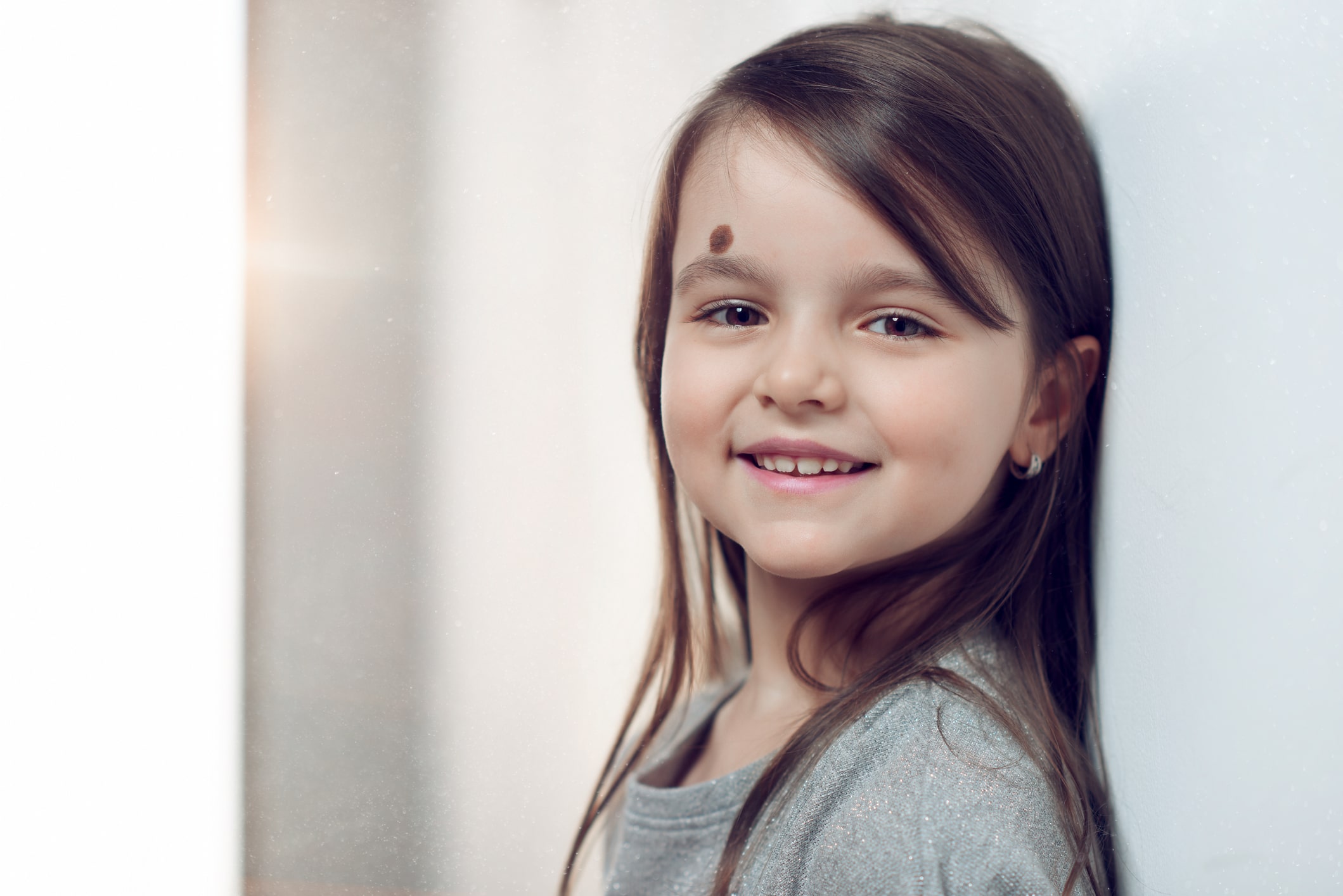 birth mark wellesley premier dermatology birth mark wellesley premier dermatology