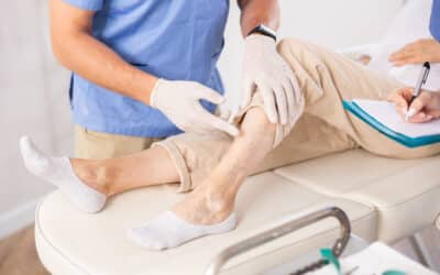 Why Sclerotherapy (Asclera) Might Be Your Best Option for Vein Treatment