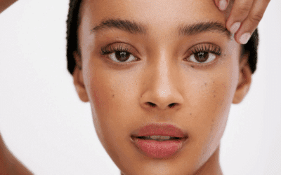 Total Health Series: The Gut Skin Axis, How Your Gut Affects Your Largest Organ